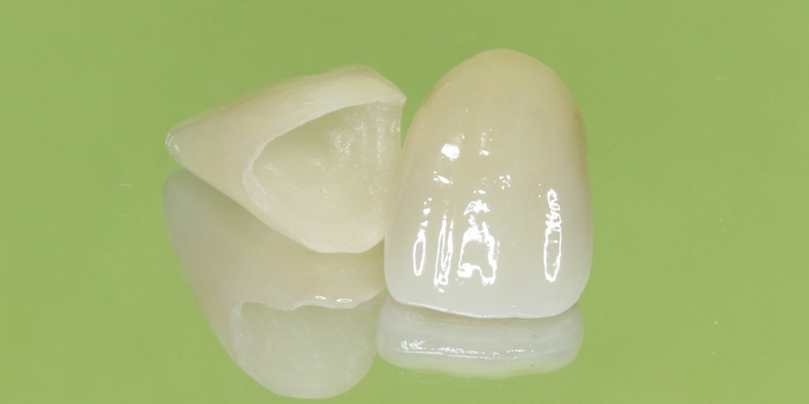 オールセラミッククラウン