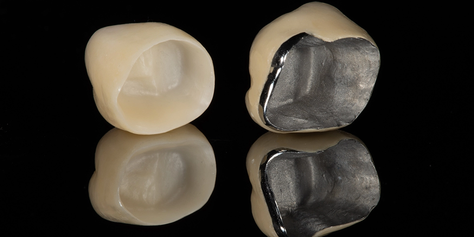 メタルボンドクラウン