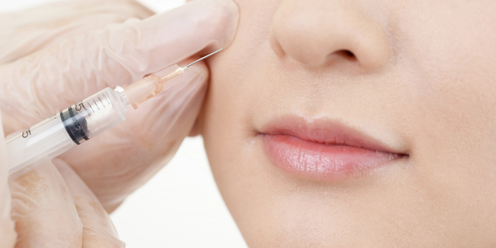 上唇の動きの問題