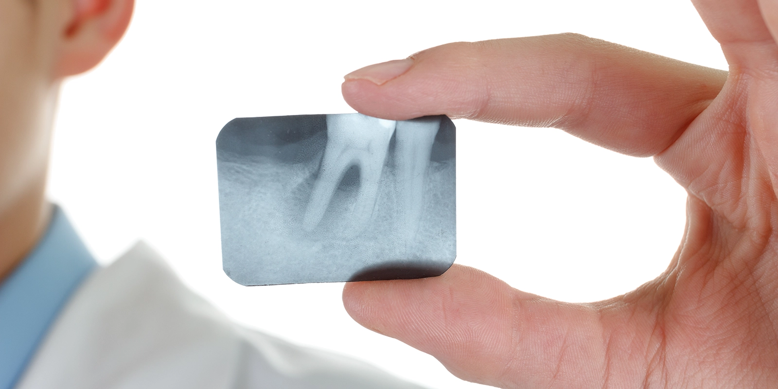 歯周病のリスクを高める要因