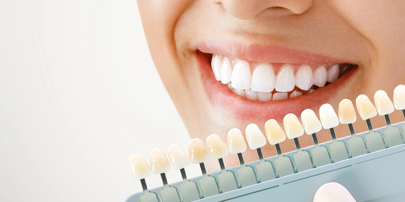 歯を削らずに白くする