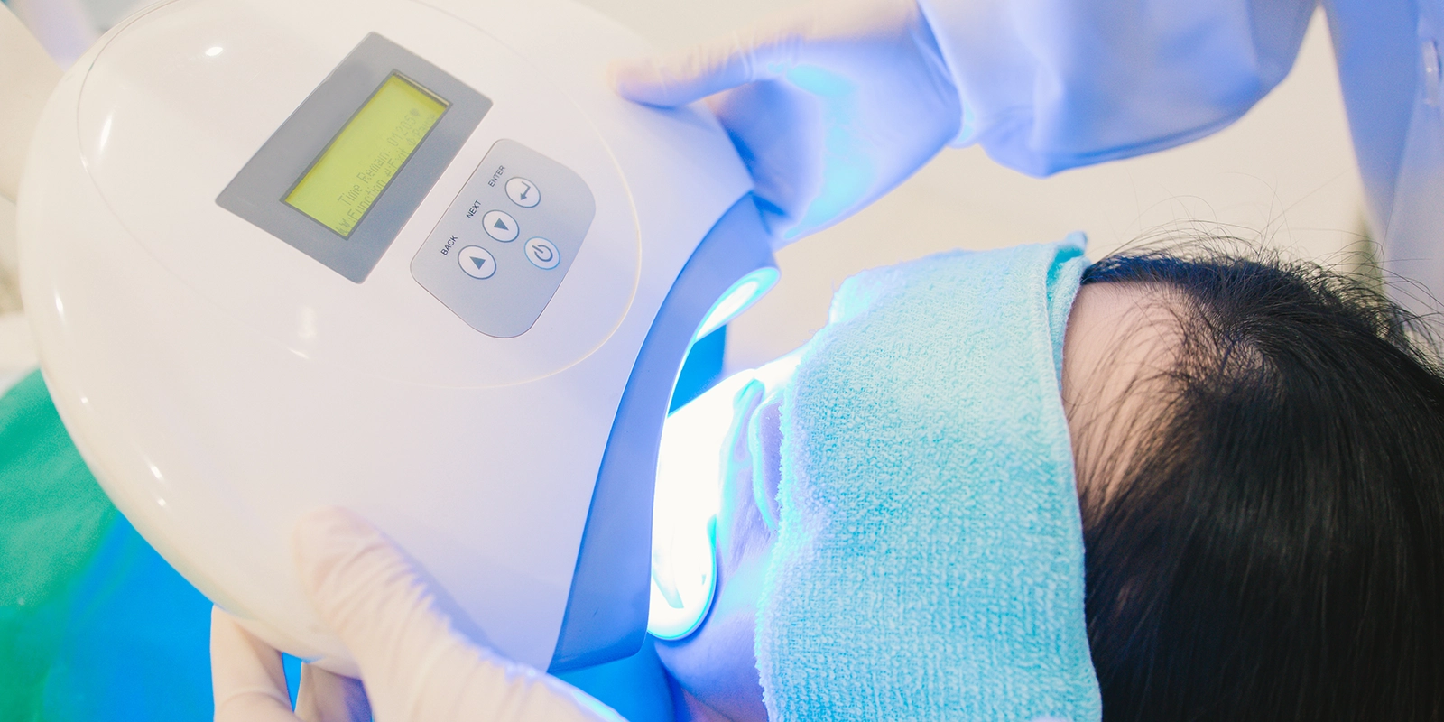 オフィスホワイトニング