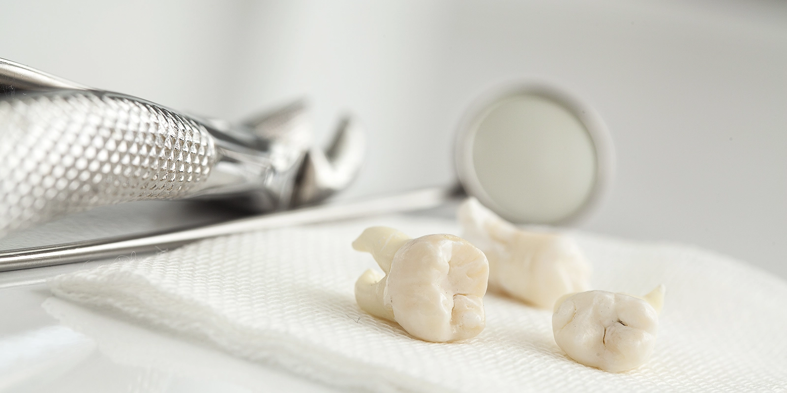 抜歯が推奨されるケース